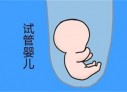 培养广州捐卵宝宝艺术细胞的小技巧